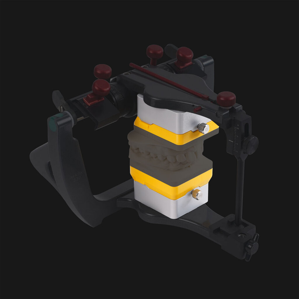 ASM 440 - Denar mit Modellen - 04 - Digital - Black BG - WEB